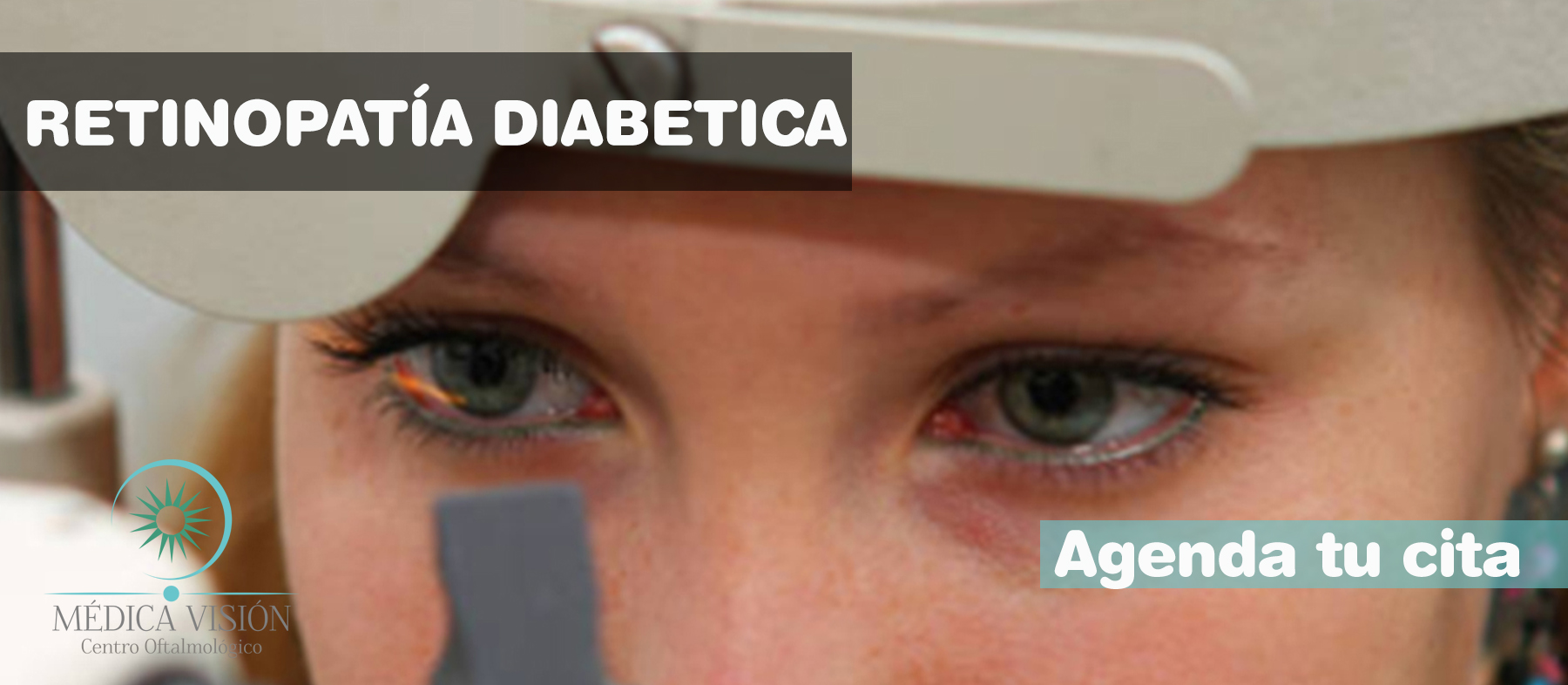  cirugia de Retinopatía diabetica 